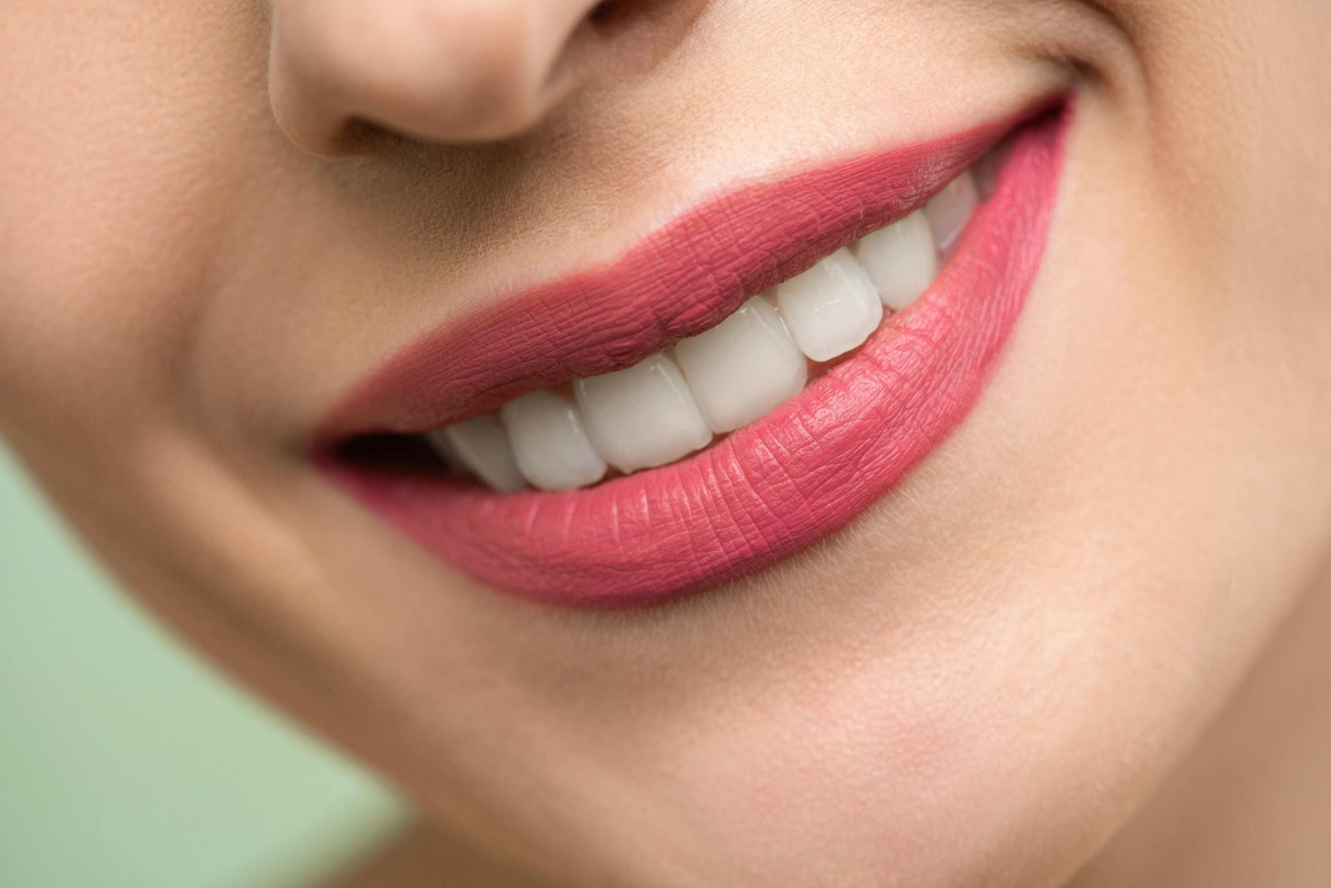 The Ultimate Guide to Teeth Whitening at Home
