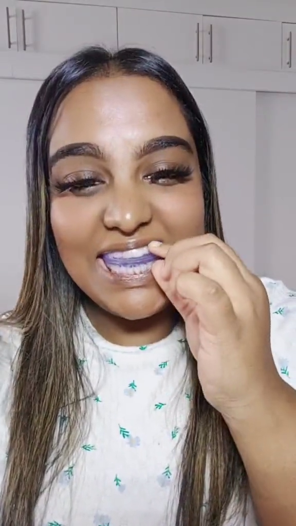 Customer demonstrates Alidon aligner use 